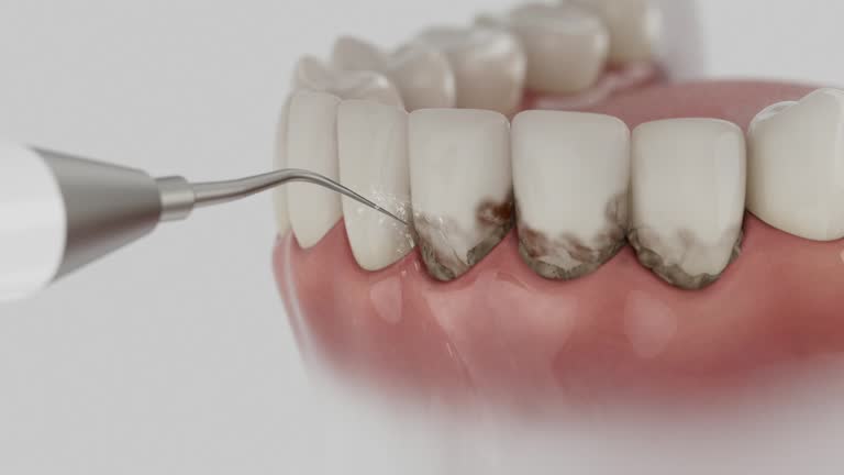 Reliable Dental Implants contractor in Calexico, CA by Smile Center Dentistry